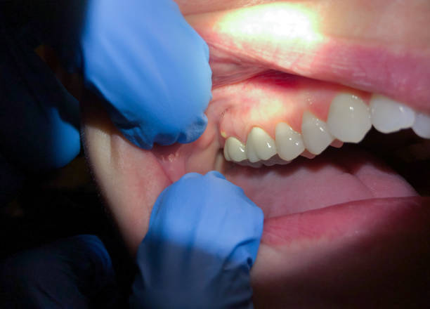 Best Orthodontic Emergency Dentist in Lake Barcroft, VA