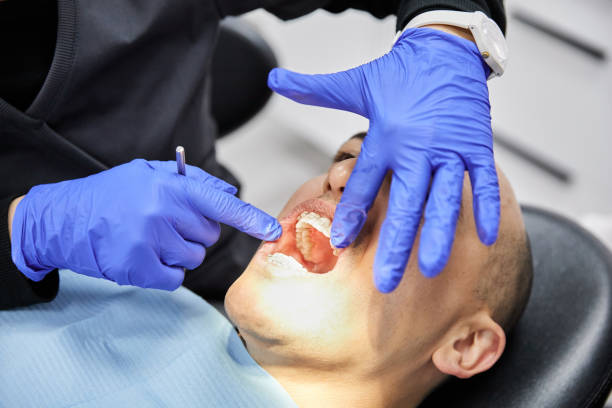 Best Emergency Root Canal Treatment in Lake Barcroft, VA